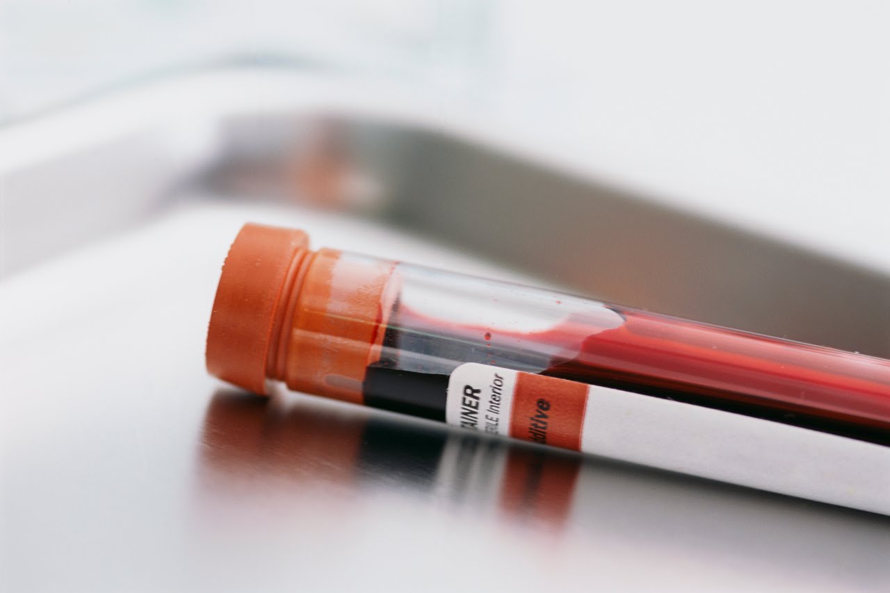 blood tube